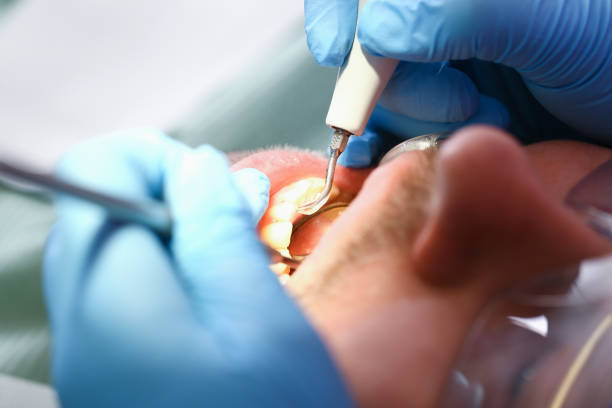 Best Same-Day Emergency Dentist in Concord, MI