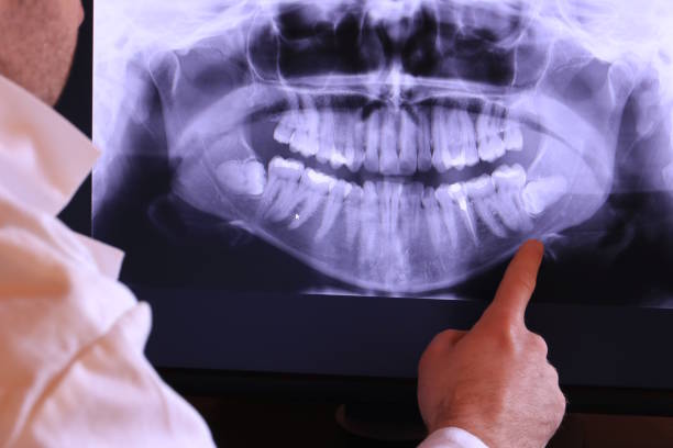 Best Emergency Dental Surgery in Concord, MI
