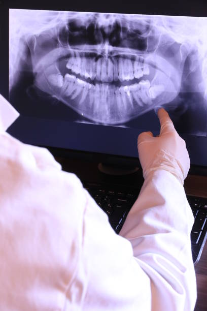 Best Emergency Broken Tooth Repair in Concord, MI