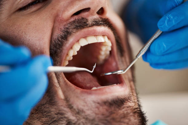 Best Walk-In Emergency Dentist in Concord, MI